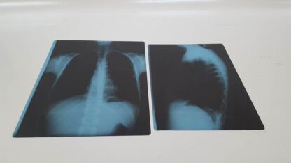 Radiografías variadas