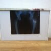 Negatoscopio visor radiografias - Imagen 2
